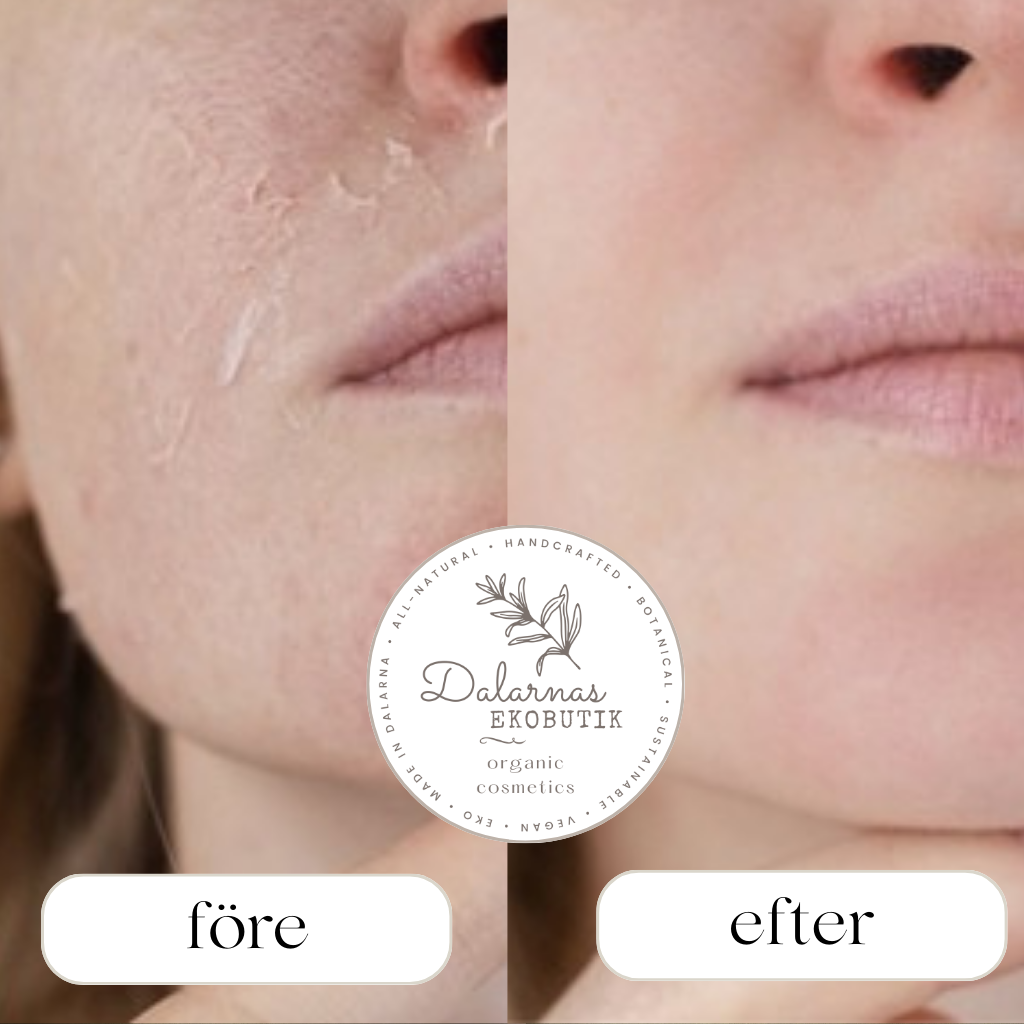 Reparera hudbarriären