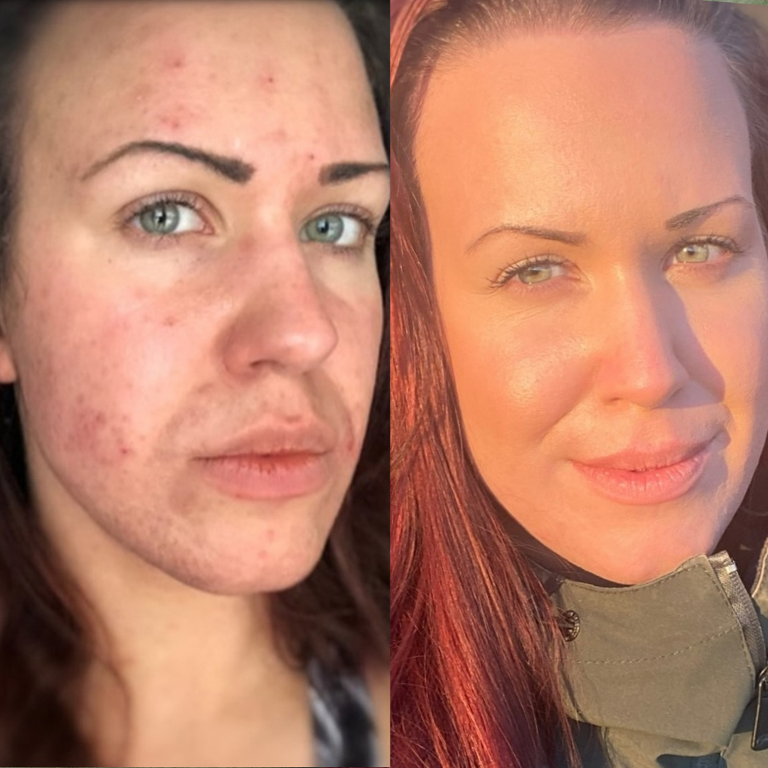 before after sofie